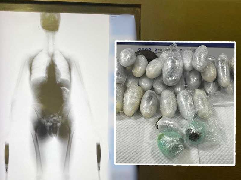                 مخدرات داخل أحشاء مسافر أوروبي قادم من لندن              